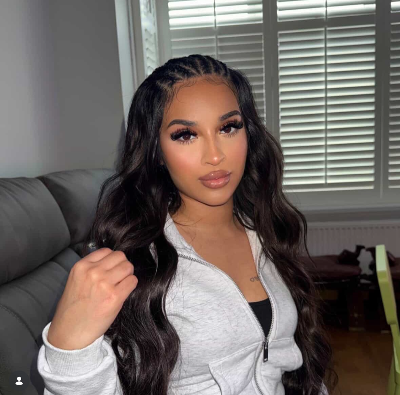 Lip-Fillers