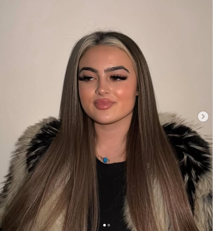 Lip-Fillers
